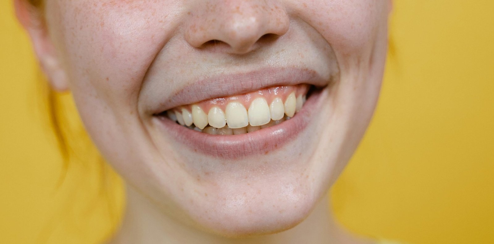 Gigi Kuning: Penyebab dan Cara Mengatasinya